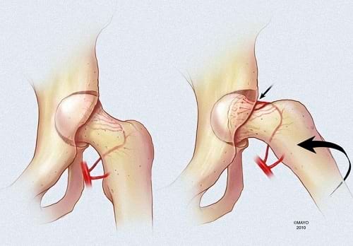 Best Orthopedic Oncology Center in Patna