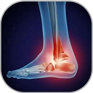 Knee joint preservation center